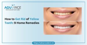 How to get rid of yellow teeth